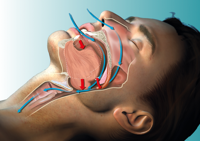 Schnarchen Loswerden - Atmung im Detail