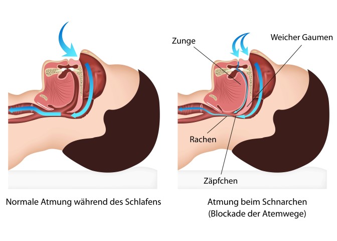Schnarchen Loswerden - Atmung während des Schlafens uns dem Schnarchens